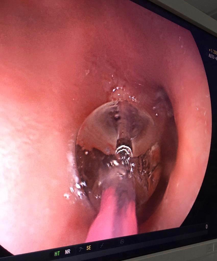 34bb97e1 bb18 499f 8704 df512bc14bee - وكالة عكاظ الاخبارية