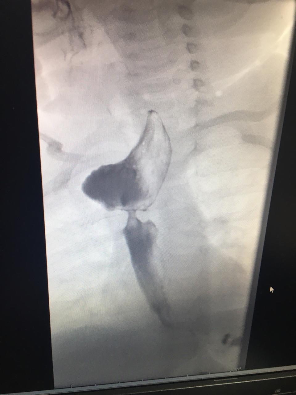 ac87211e 060d 4613 8391 881e68229395 - وكالة عكاظ الاخبارية