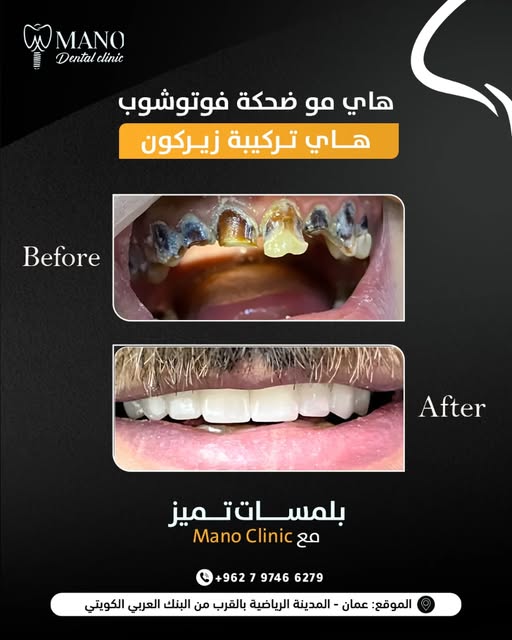 491433662 18012535577711194 2703049185535344645 n - وكالة عكاظ الاخبارية