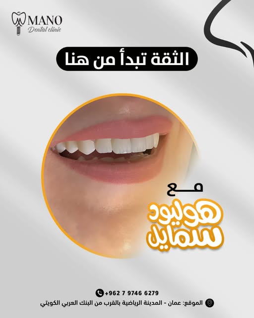 491446389 18012217010711194 655476410648055006 n - وكالة عكاظ الاخبارية