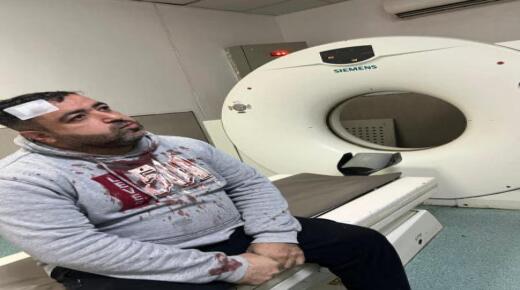 ملثمان يهاجمان الصحفي الأردني فيصل التميمي أمام أطفاله وزوجته (شاهد الفيديو )