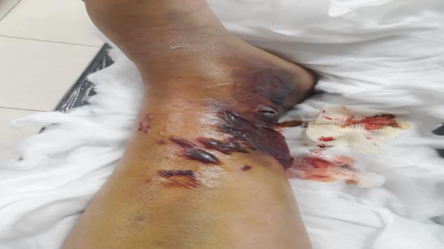 كركيون لمن نشكي حال المستشفى الحكومي في الكرك