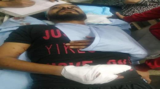 ٨ أشخاص من سائقي الباصات الخصوصي في حكما يهاجمون سائق حافلة عمومي بالسيوف – صور