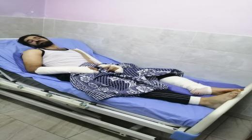 الاعتداء على معلم مدرسة في عجلون واصابته بعدة كسور